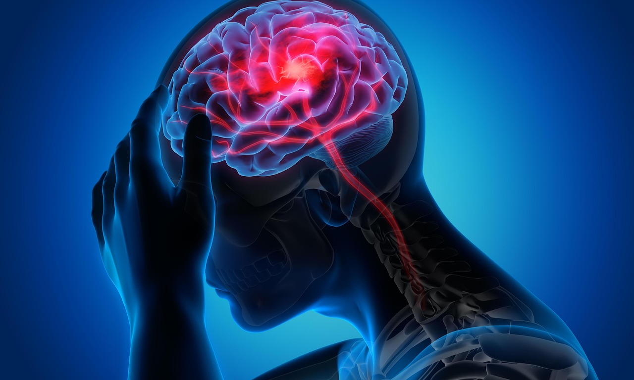 Migraine-Dien-Chan-Marie-Neuville-sur-Saone